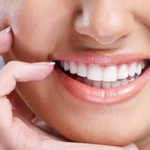 estetik-dis-tedavisinde-bonding-sureci-nedir-R9aDyJP3.jpg