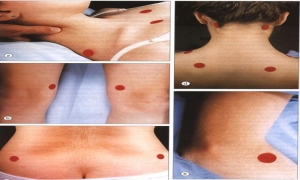 fibromiyalji-nedir-tedavisi-mumkun-mudur-ZgwrbW4x.jpg