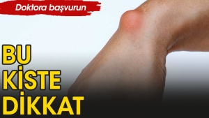 ganglion-kisti-nedir-X9895Q8N.jpg