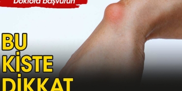 ganglion-kisti-nedir-X9895Q8N.jpg