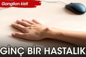 ganglion-kisti-nedir-nelere-dikkat-edilmelidir-VzEMYHuW.jpg