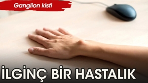ganglion-kisti-nedir-nelere-dikkat-edilmelidir-VzEMYHuW.jpg