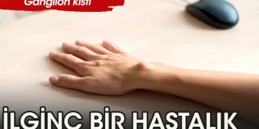 ganglion-kisti-nedir-nelere-dikkat-edilmelidir-VzEMYHuW.jpg