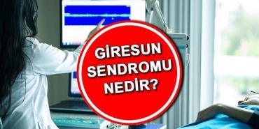 giresun-sendromu-nedir-belirtileri-nelerdir-giresun-sendromu-ne-demek-tip-literaturune-girdi-iste-dunyada-e3EAIHS1.jpg