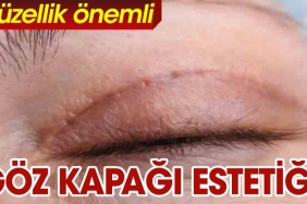 goz-kapagi-estetigi-hakkinda-az-bilinenler-yZs7PAnK.jpg