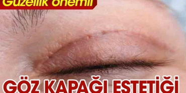 goz-kapagi-estetigi-hakkinda-az-bilinenler-yZs7PAnK.jpg