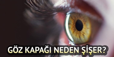 goz-kapagi-neden-siser-nasil-gecer-goz-kapagi-sismesine-ne-l-gelir-Cd6tFXqK.jpg