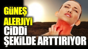 gunes-alerjiyi-onemli-formda-arttiriyor-jQGTeESW.jpg