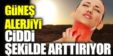 gunes-alerjiyi-onemli-formda-arttiriyor-jQGTeESW.jpg