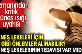 gunes-lekeleri-icin-ne-uzere-tedbirler-alinabilir-gunes-lekelerinin-tedavisi-var-midir-mpl19p7M.jpg