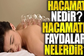 hacamat-nedir-hacamat-nasil-yapilir-yararlari-nelerdir-hyG4cAVU.jpg