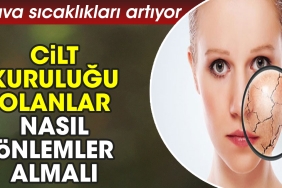 hava-sicakliklari-artiyor-cilt-kurulugu-olanlar-nasil-tedbirler-almali-u1EVBL16.jpg