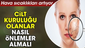 hava-sicakliklari-artiyor-cilt-kurulugu-olanlar-nasil-tedbirler-almali-u1EVBL16.jpg