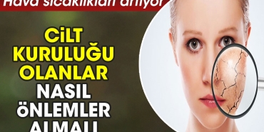 hava-sicakliklari-artiyor-cilt-kurulugu-olanlar-nasil-tedbirler-almali-u1EVBL16.jpg