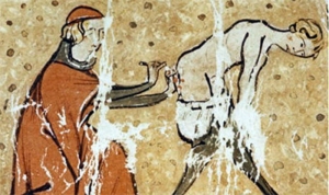 hemoroid-basur-hastaligi-nedir-ve-tedavisi-nasil-olur-exl8EVA8.jpg