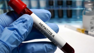 hepatit-a-nedir-hepatit-a-belirtileri-neler-gBFrzhqO.jpg