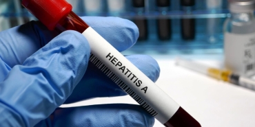 hepatit-a-nedir-hepatit-a-belirtileri-neler-gBFrzhqO.jpg