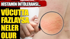 histamin-intoleransi-nedir-vAivAGpf.jpg