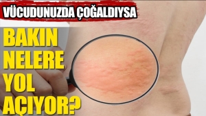 histamin-nedir-r11ZfaYa.jpg