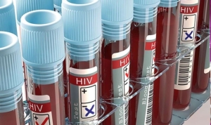 hiv-virusu-nedir-belirtileri-nelerdir-hiv-enfeksiyonu-aids-nasil-bulasir-cWzkCsvk.jpg