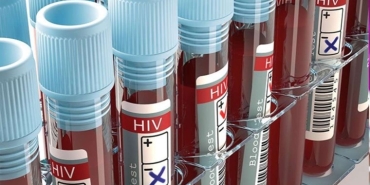 hiv-virusu-nedir-belirtileri-nelerdir-hiv-enfeksiyonu-aids-nasil-bulasir-kW78Q7Dr.jpg