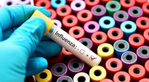 influenza-nedir-belirtileri-nelerdir-2LXZ3Pfm.jpg