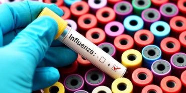 influenza-nedir-belirtileri-nelerdir-2LXZ3Pfm.jpg