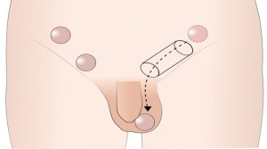 inmemis-testis-nedir-JWjrqwKz.jpg