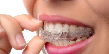 invisalign-nedir-jXPi5b1s.jpg