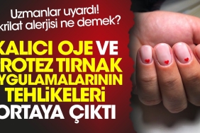 kalici-oje-ve-protez-tirnak-uygulamalarinin-tehlikeleri-ortaya-cikti-uzmanlar-uyardi-akrilat-alerjisi-ne-jchywuRg.jpg