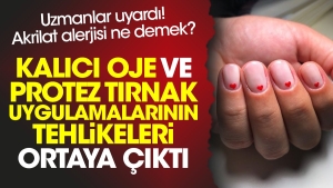 kalici-oje-ve-protez-tirnak-uygulamalarinin-tehlikeleri-ortaya-cikti-uzmanlar-uyardi-akrilat-alerjisi-ne-jchywuRg.jpg