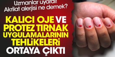 kalici-oje-ve-protez-tirnak-uygulamalarinin-tehlikeleri-ortaya-cikti-uzmanlar-uyardi-akrilat-alerjisi-ne-jchywuRg.jpg