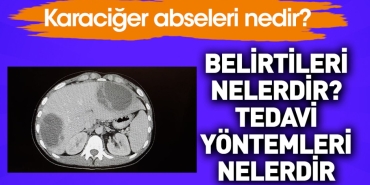 karaciger-abseleri-nedir-belirtileri-nelerdir-tedavi-usulleri-nelerdir-hXvyufXh.jpg