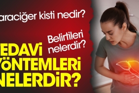 karaciger-kisti-nedir-belirtileri-nelerdir-tedavi-usulleri-nelerdir-kg7XSCvX.jpg