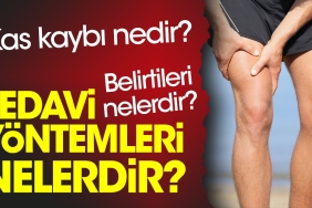 kas-kaybi-nedir-kas-kaybi-belirtileri-nelerdir-kas-kaybi-tedavi-prosedurleri-nelerdir-OAqKAKyz.jpg