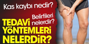 kas-kaybi-nedir-kas-kaybi-belirtileri-nelerdir-kas-kaybi-tedavi-prosedurleri-nelerdir-OAqKAKyz.jpg