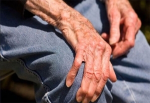 kemik-erimesi-osteoporoz-nedir-nasil-tedavi-edilir-kemik-erimesi-tanisi-nasil-konulur-S2MdhXWQ.jpg