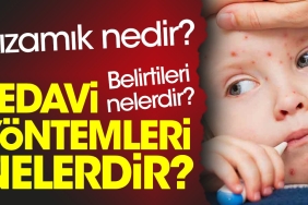 kizamik-nedir-kizamik-belirtileri-nelerdir-kizamik-tedavi-teknikleri-nelerdir-OL9Xpygj.jpg