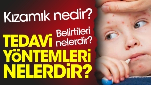 kizamik-nedir-kizamik-belirtileri-nelerdir-kizamik-tedavi-teknikleri-nelerdir-OL9Xpygj.jpg