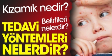 kizamik-nedir-kizamik-belirtileri-nelerdir-kizamik-tedavi-teknikleri-nelerdir-OL9Xpygj.jpg