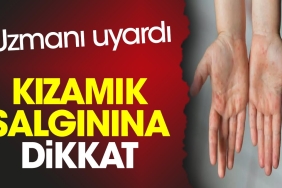 kizamik-salginina-dikkat-uzmani-uyardi-VJTr58de.jpg