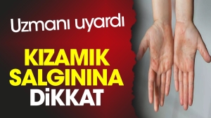 kizamik-salginina-dikkat-uzmani-uyardi-VJTr58de.jpg