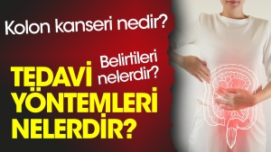 kolon-kanseri-nedir-kolon-kanseri-belirtileri-nelerdir-kolon-kanseri-tedavi-teknikleri-nelerdir-y4yMh56q.jpg