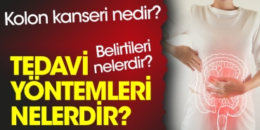 kolon-kanseri-nedir-kolon-kanseri-belirtileri-nelerdir-kolon-kanseri-tedavi-teknikleri-nelerdir-y4yMh56q.jpg