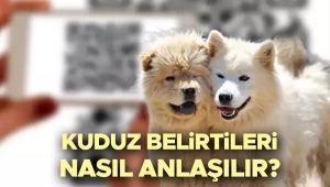 kuduz-nedir-belirtileri-nelerdir-kuduz-nasil-bulasir-kuduz-asisi-ne-vakit-yapilir-iste-hUAXHuG6.jpg