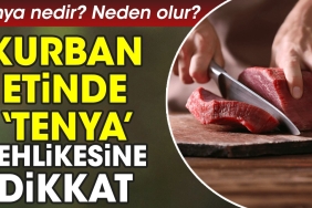kurban-etinde-tenya-tehlikesine-dikkat-tenya-nedir-neden-olur-FzgUEVzM.jpg