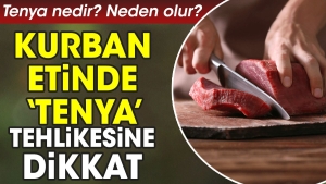 kurban-etinde-tenya-tehlikesine-dikkat-tenya-nedir-neden-olur-FzgUEVzM.jpg