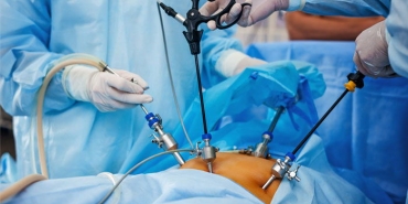laparoskopi-nedir-iPQtxZUa.jpg