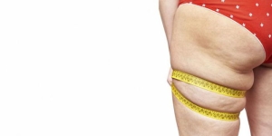 lipodem-nedir-VOYDhTXe.jpg