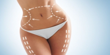 liposuction-sureci-yag-alma-nedir-j1RlIqxu.jpg